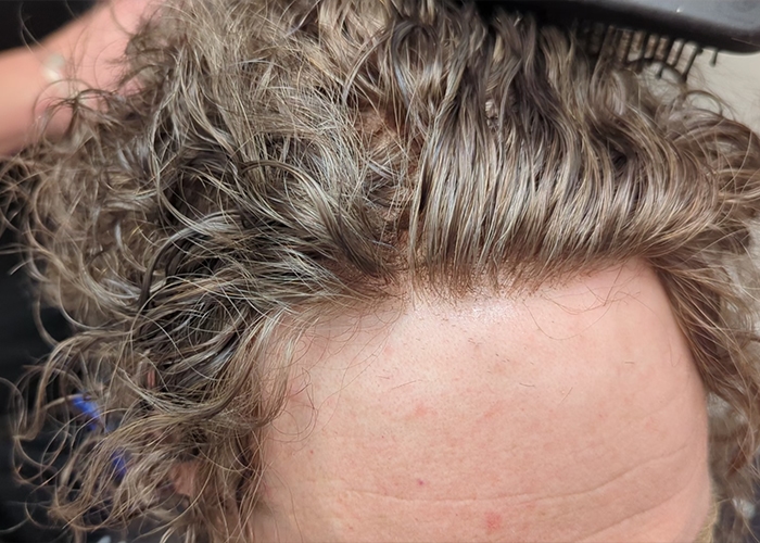 Long Hair Hair System perfectly fitted and you can't tell the difference
