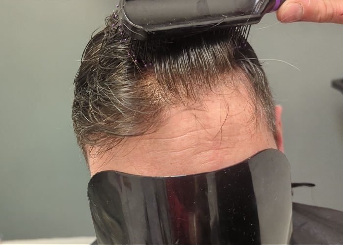 Hair System showing invisible the hair roots