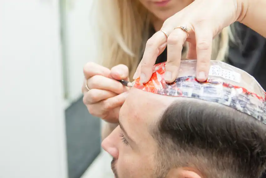 Hair Systems vs. Hair Transplants: Which Is Better for You