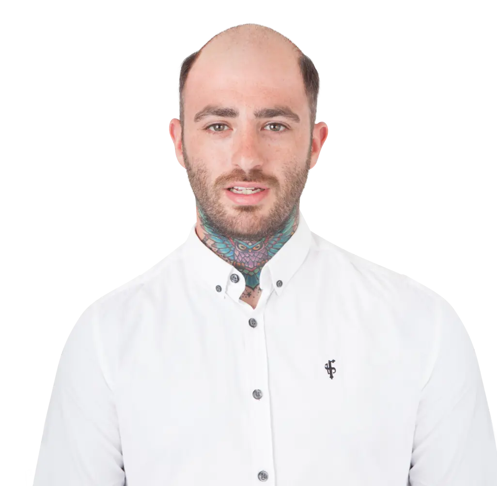 Bespoke Hair Systems, Wigs, Hair Pieces & Toupees image showing man before fitting